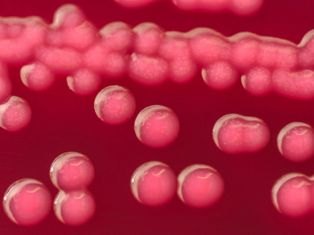 eseherija coli
